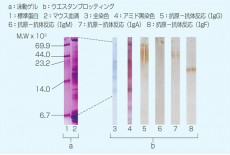Transfer Protein/Hybridization Membrane Filter Transfer Protein/Hybridization Membrane Filter